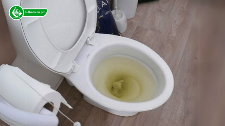 Dấu hiệu nước bồn cầu xuống chậm